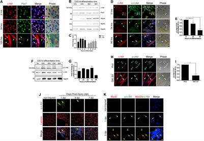 c-Abl Kinase Is Required for Satellite Cell Function Through Pax7 Regulation